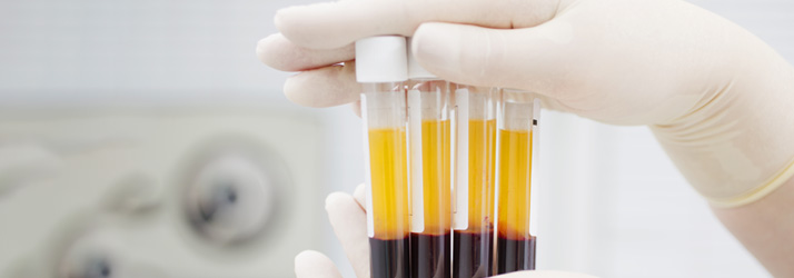 Pain Management Wilsonville OR Regen Medicine